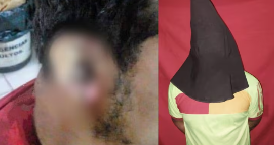 Hombre sufre grave herida en la oreja tras disputa en Itá