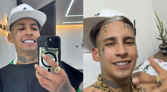 L-Gante luce su nueva sonrisa tras arreglarse la dentadura