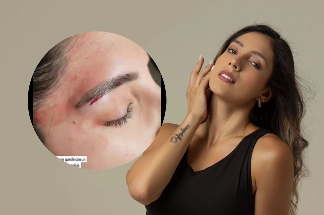 El tremendo golpe que tuvo Silvia Romero en la cabeza